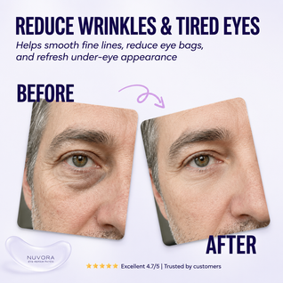 Nuvora™ Eye Repair Patches