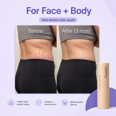 Avelis™ Silicone Scar Stick