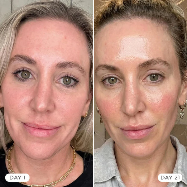 Depuffed In Days, Sculpted In Weeks